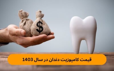 قیمت کامپوزیت دندان در سال ۱۴۰۳