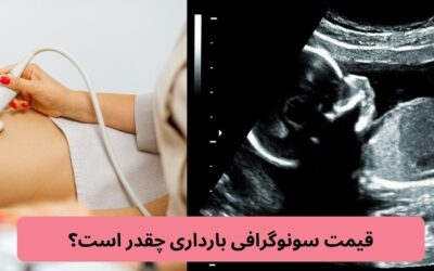 قیمت سونوگرافی بارداری چقدر است؟