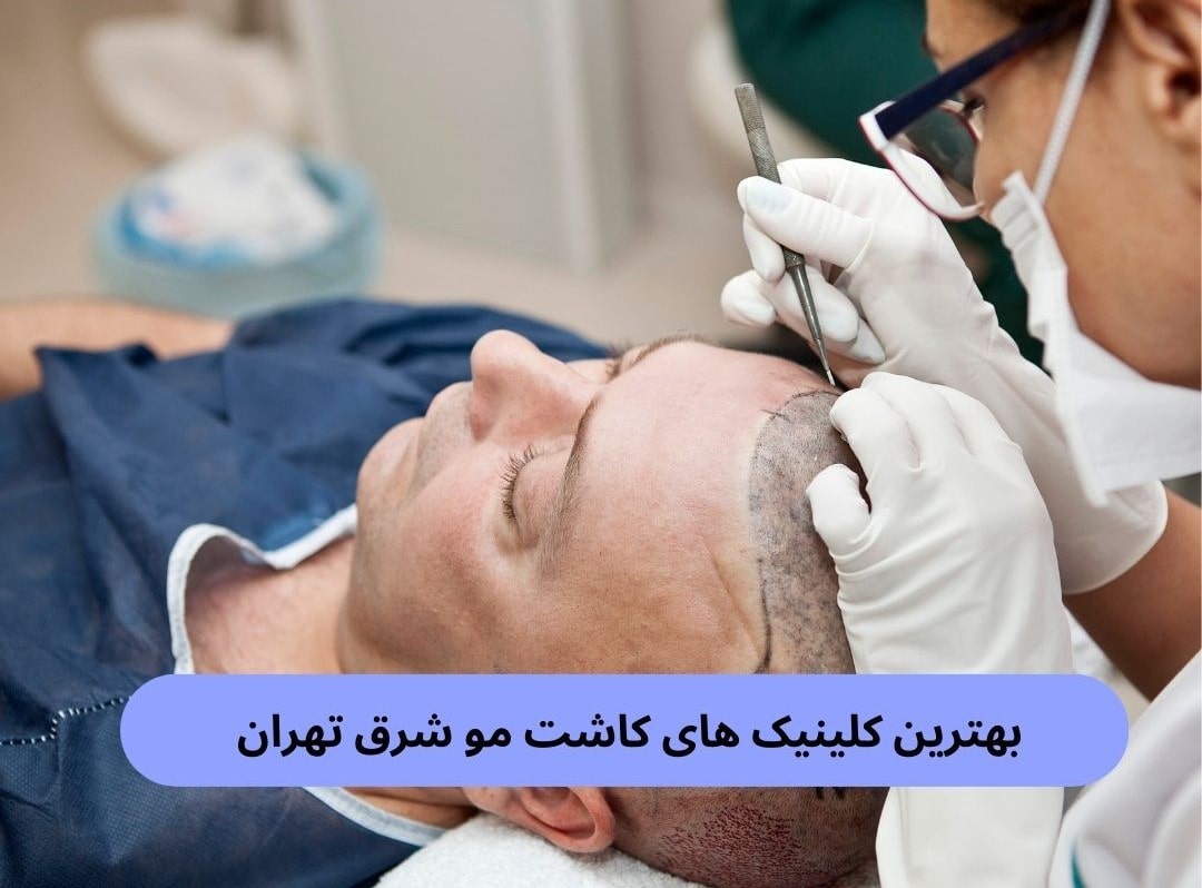 بهترین کلینیک های کاشت مو شرق تهران