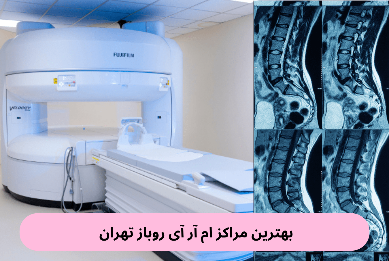 بهترین مراکز ام آر آی روباز تهران