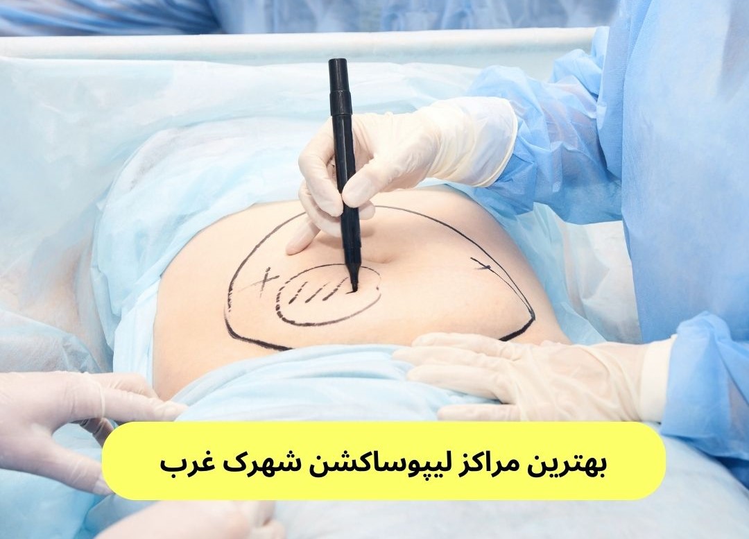 بهترین مراکز لیپوساکشن شهرک غرب
