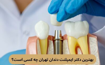 بهترین دکتر ایمپلنت دندان تهران چه کسی است؟