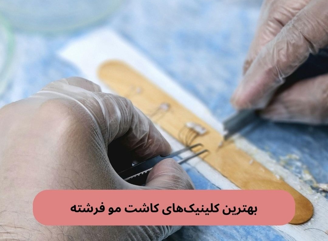 بهترین کلینیک های کاشت مو فرشته