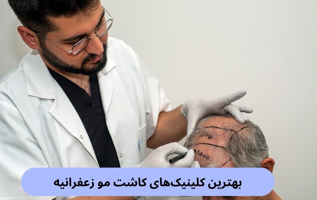 بهترین کلینیک_های کاشت مو زعفرانیه