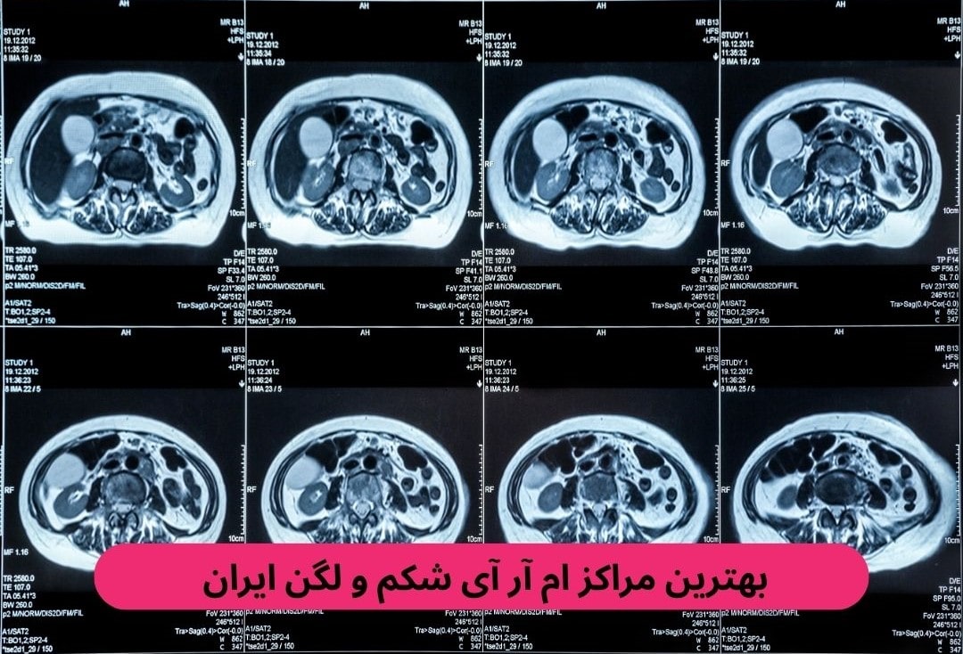 بهترین مراکز ام آر آی شکم و لگن ایران