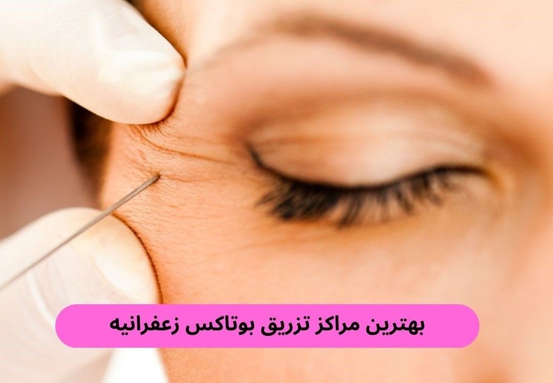 بهترین مراکز تزریق بوتاکس زعفرانیه