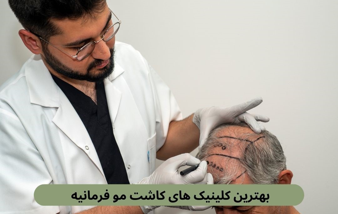 بهترین کلینیک های کاشت مو فرمانیه