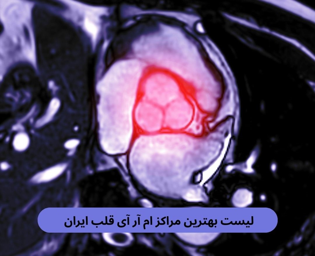 بهترین مراکز ام آر آی قلب ایران