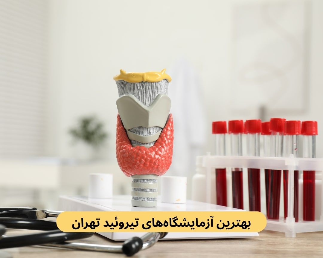 بهترین آزمایشگاه‌های تیروئید تهران