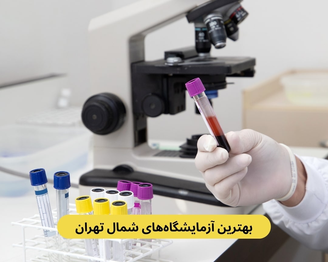 بهترین آزمایشگاه‌های شمال تهران