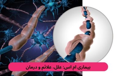 بیماری ام اس: علل، علائم و درمان