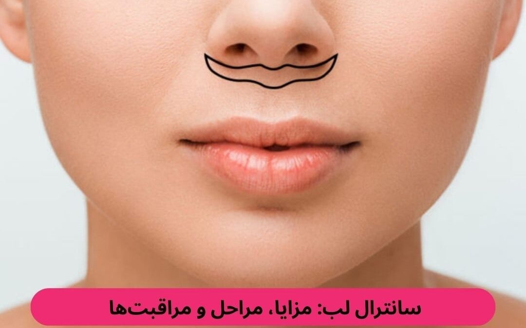 سانترال لب: مزایا، مراحل و مراقبت‌ها