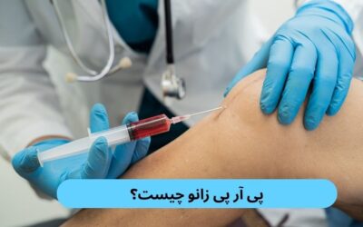 پی آر پی زانو چیست؟