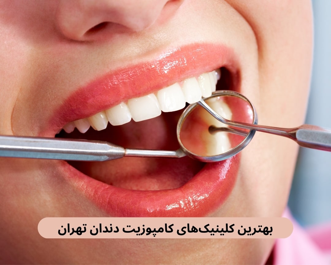 بهترین کلینیک های کامپوزیت دندان تهران بهترین کلینیک های کامپوزیت دندان تهران