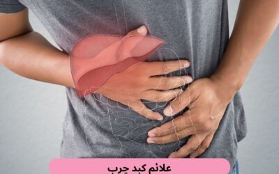 علائم کبد چرب