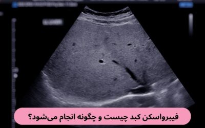 فیبرو اسکن کبد چیست و چگونه انجام می‌شود؟