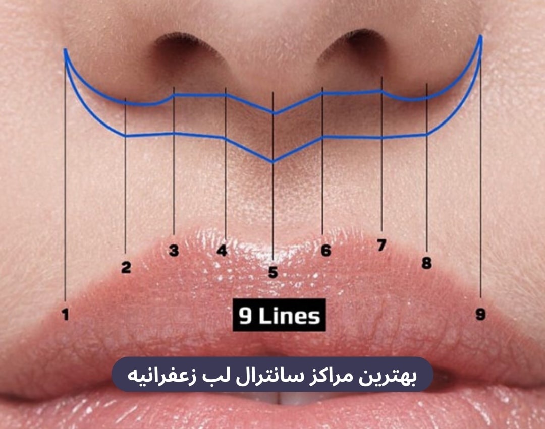بهترین مراکز سانترال لب زعفرانیه