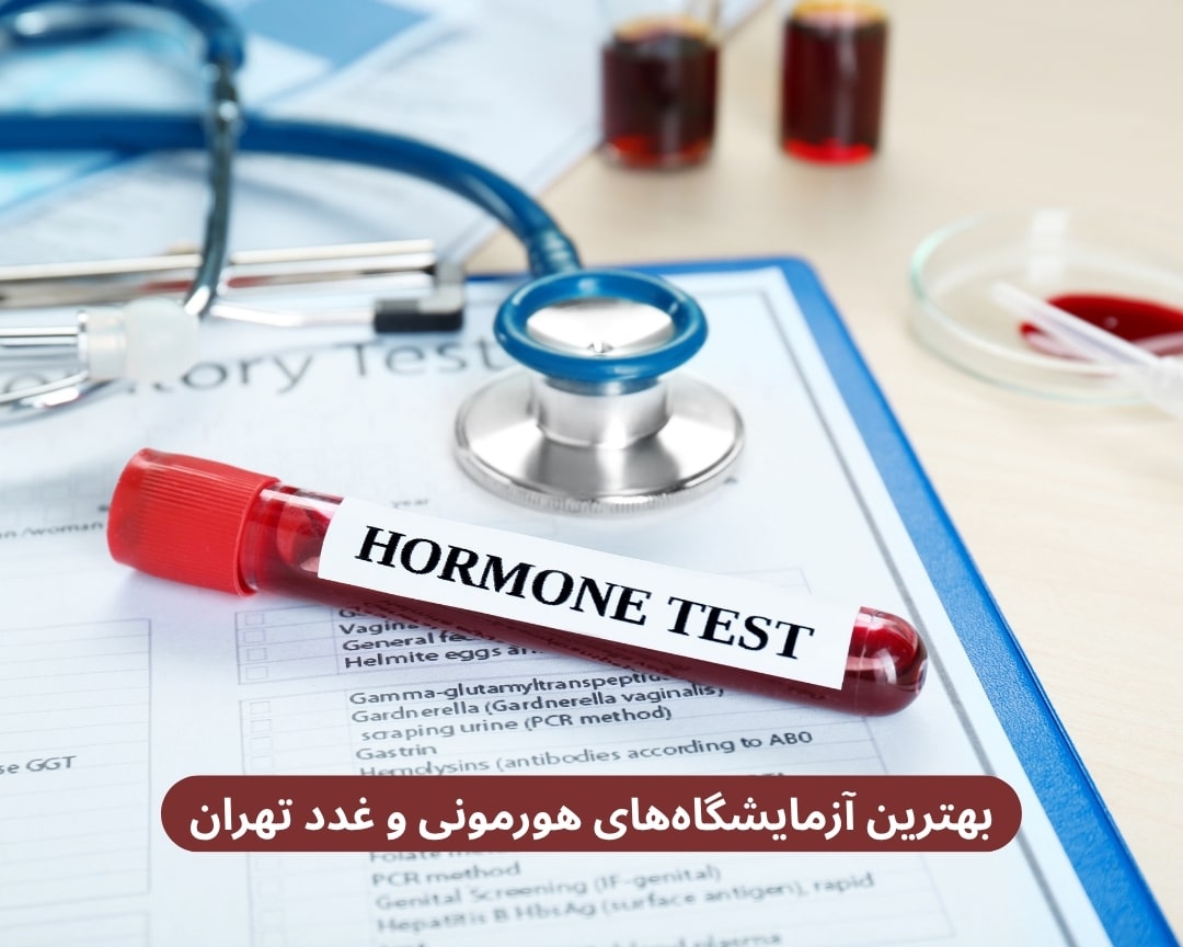 بهترین آزمایشگاه ‌های هورمونی و غدد تهران