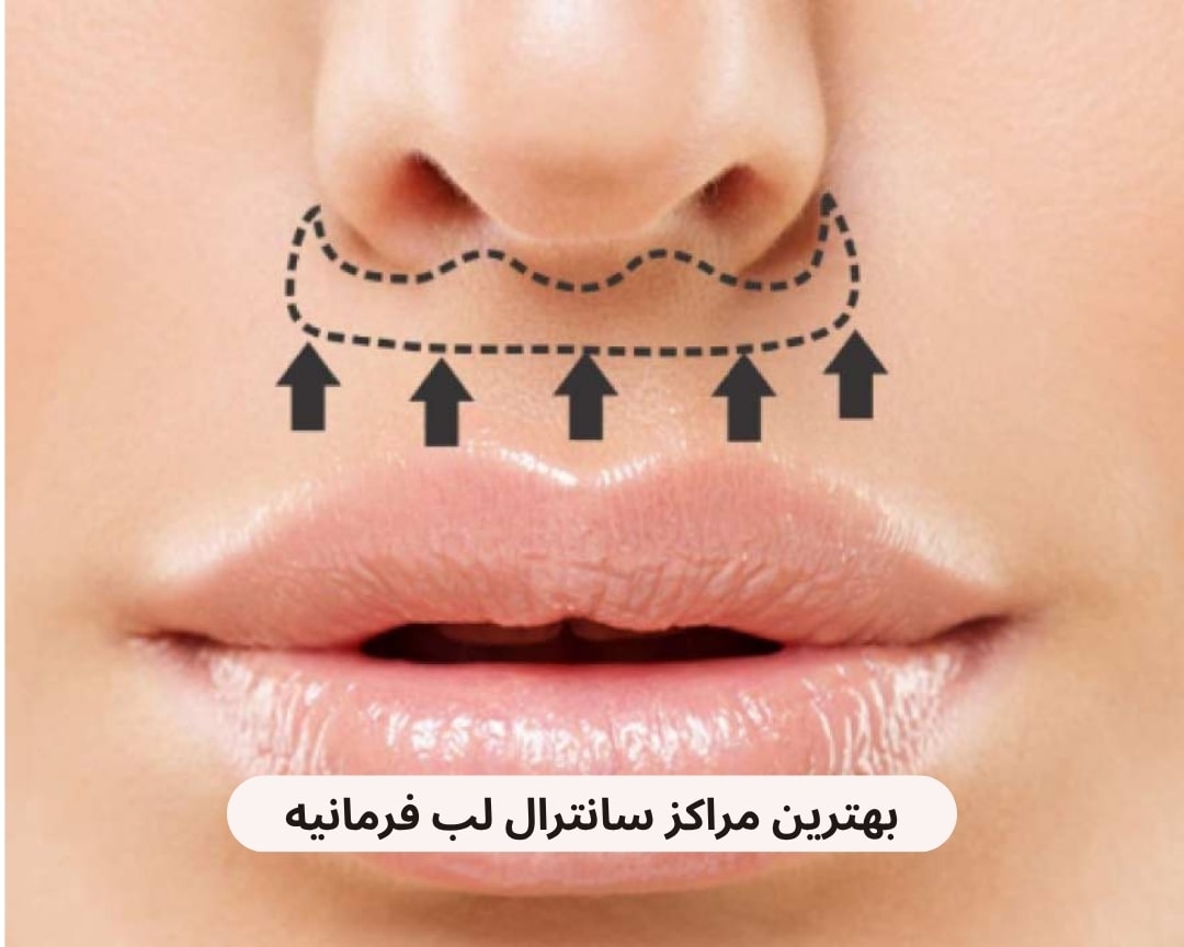 بهترین مراکز سانترال لب فرمانیه