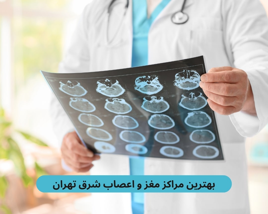 بهترین مراکز مغز و اعصاب شرق تهران