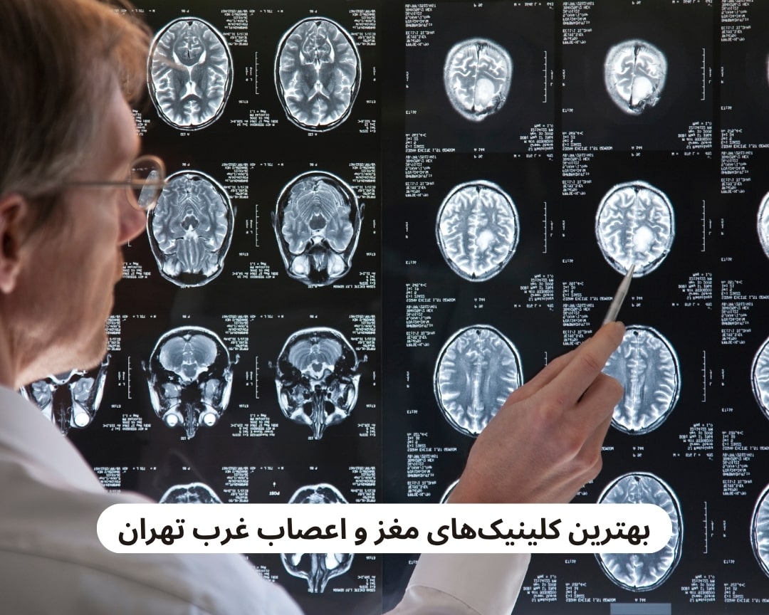 بهترین کلینیک های مغز و اعصاب غرب تهران