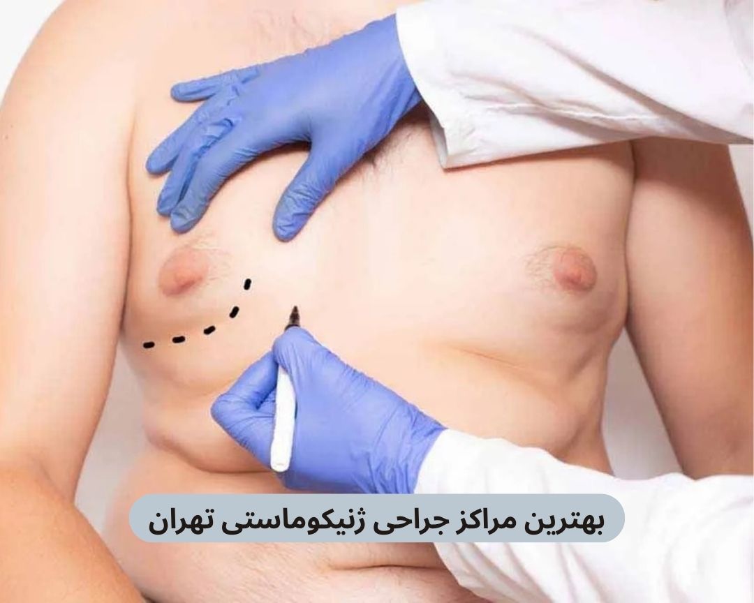 بهترین مراکز جراحی ژنیکوماستی تهران
