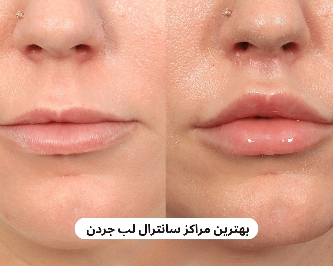 بهترین مراکز سانترال لب جردن