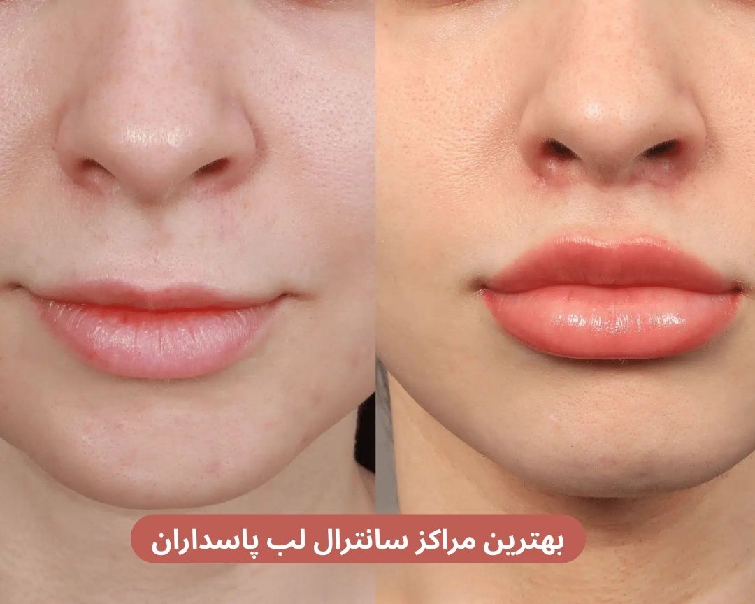 بهترین مراکز سانترال لب پاسداران