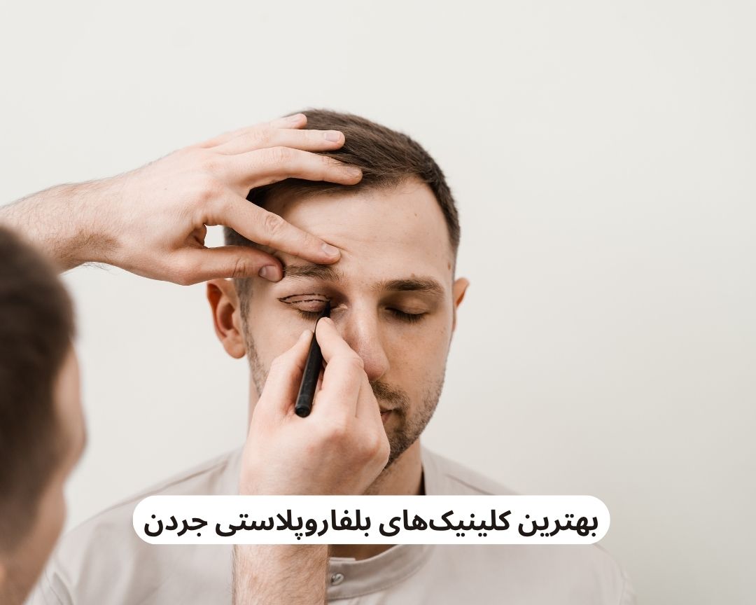 بهترین کلینیک های بلفاروپلاستی جردن