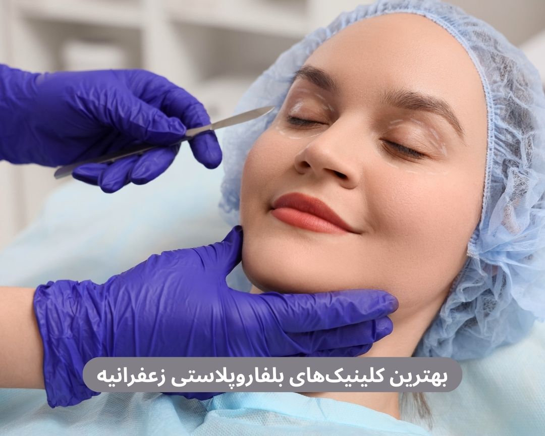بهترین کلینیک های بلفاروپلاستی زعفرانیه
