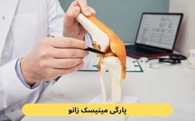 پارگی مینیسک زانو