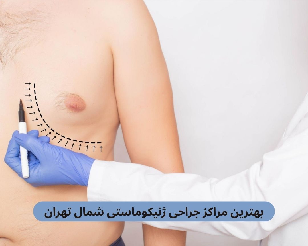 بهترین مراکز جراحی ژنیکوماستی شمال تهران