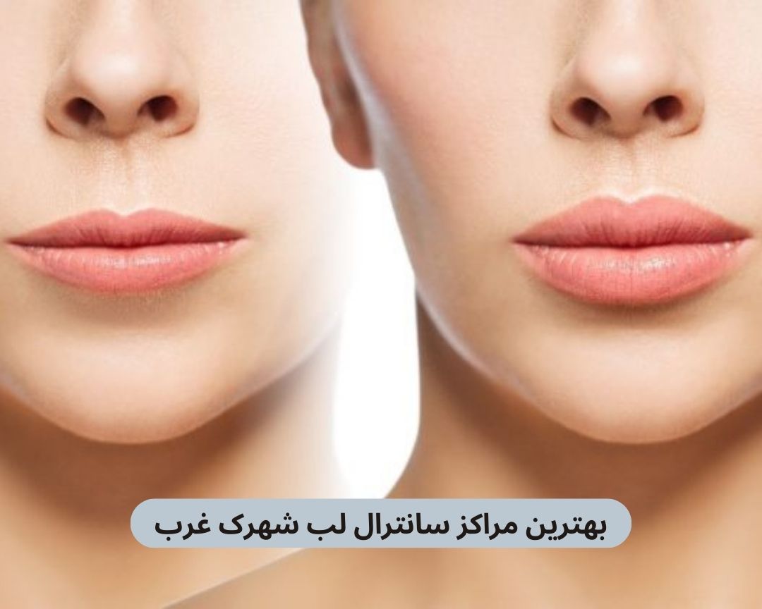 بهترین مراکز سانترال لب شهرک غرب