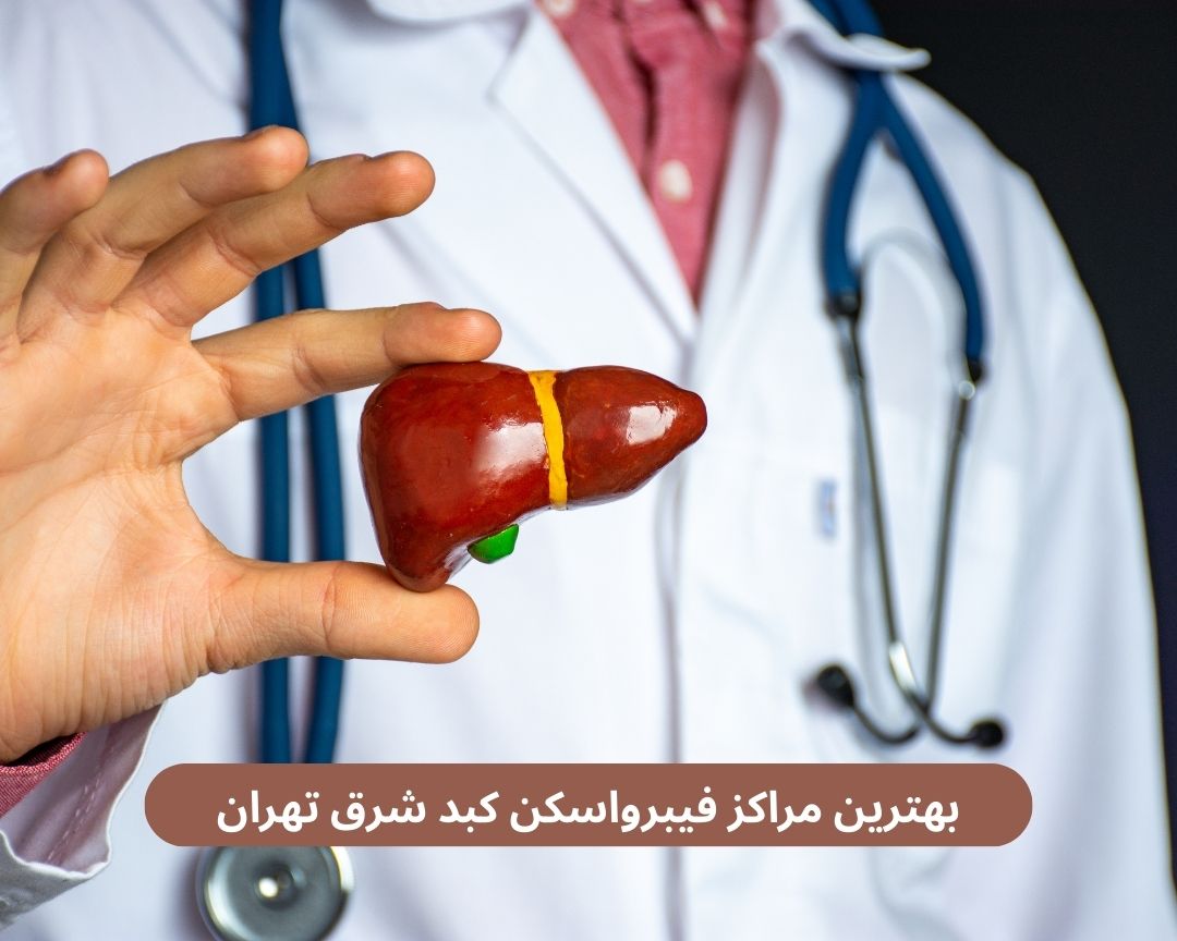 بهترین مراکز فیبرواسکن کبد شرق تهران
