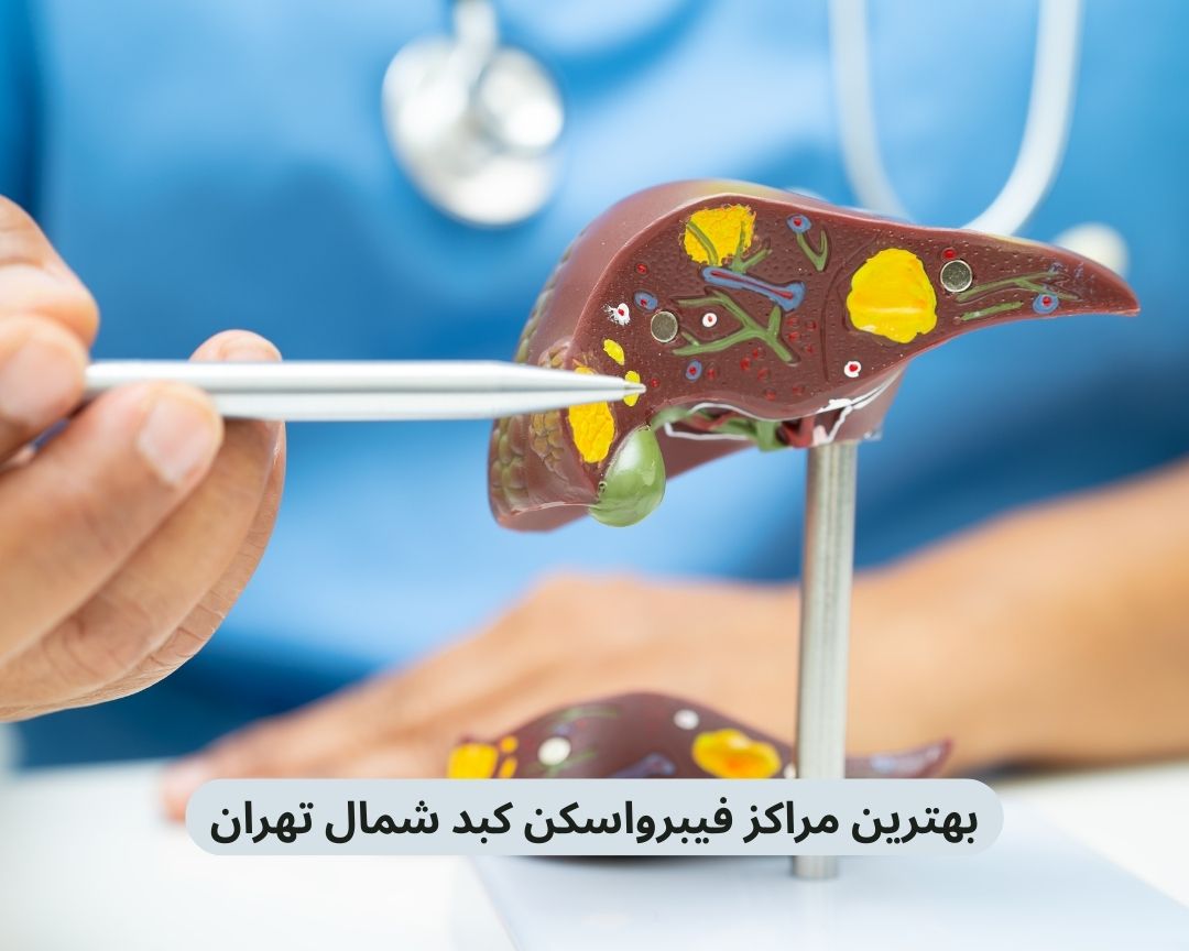 بهترین مراکز فیبرواسکن کبد شمال تهران