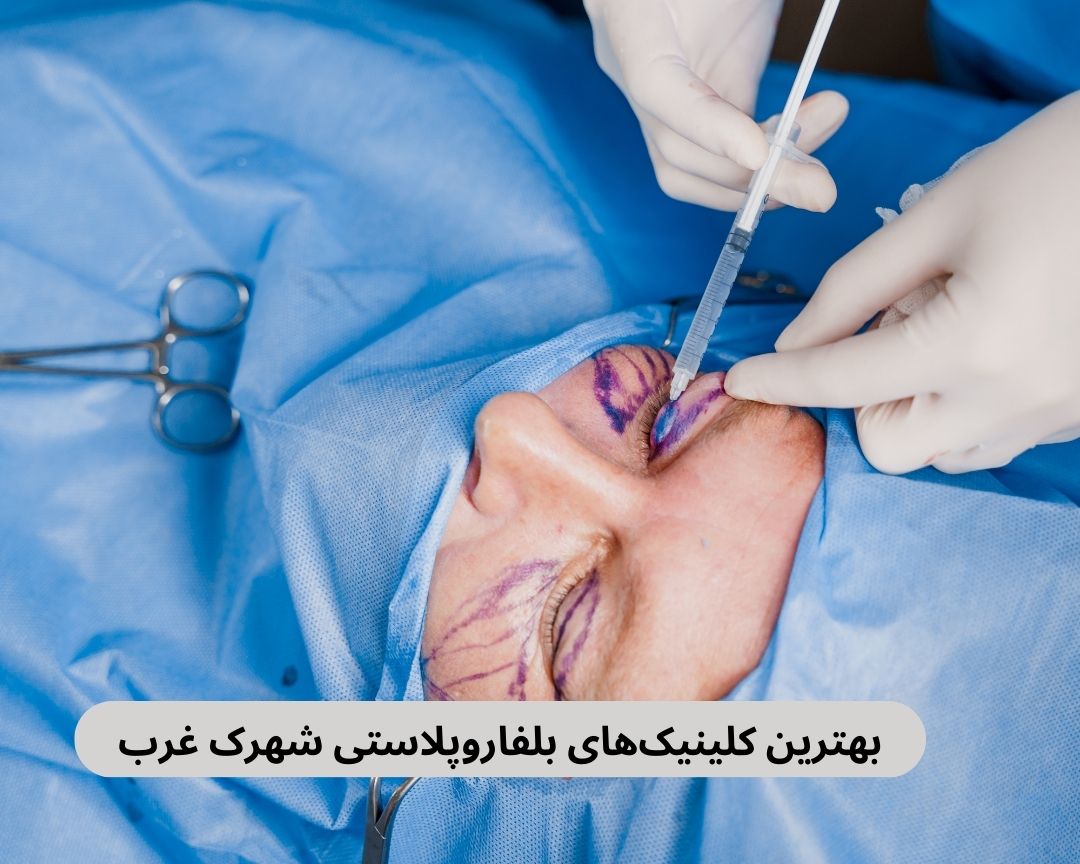 بهترین کلینیک های بلفاروپلاستی شهرک غرب