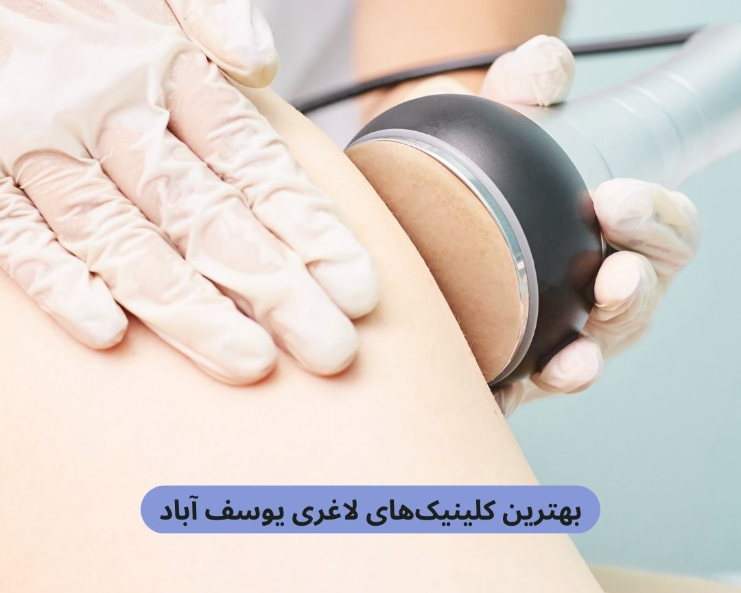 بهترین کلینیک های لاغری یوسف آباد