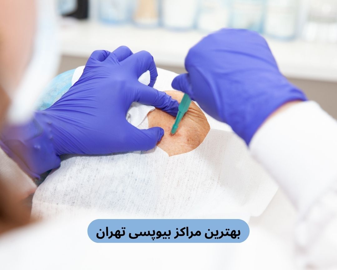 بهترین مراکز بیوپسی تهران