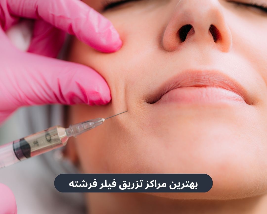 بهترین مراکز تزریق فیلر فرشته