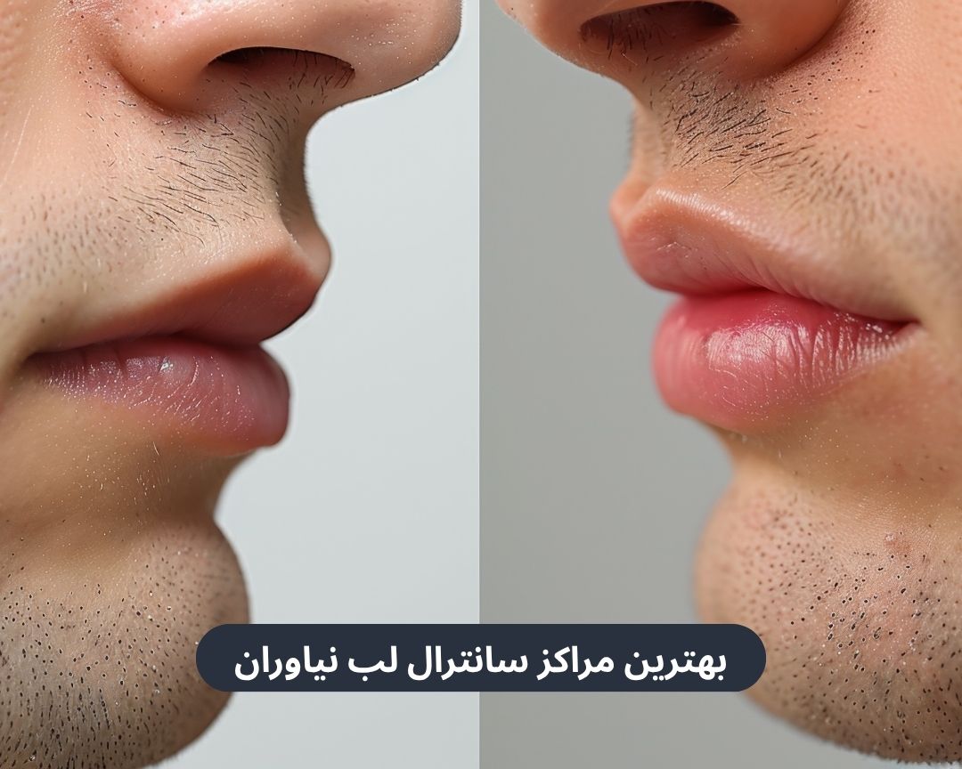 بهترین مراکز سانترال لب نیاوران