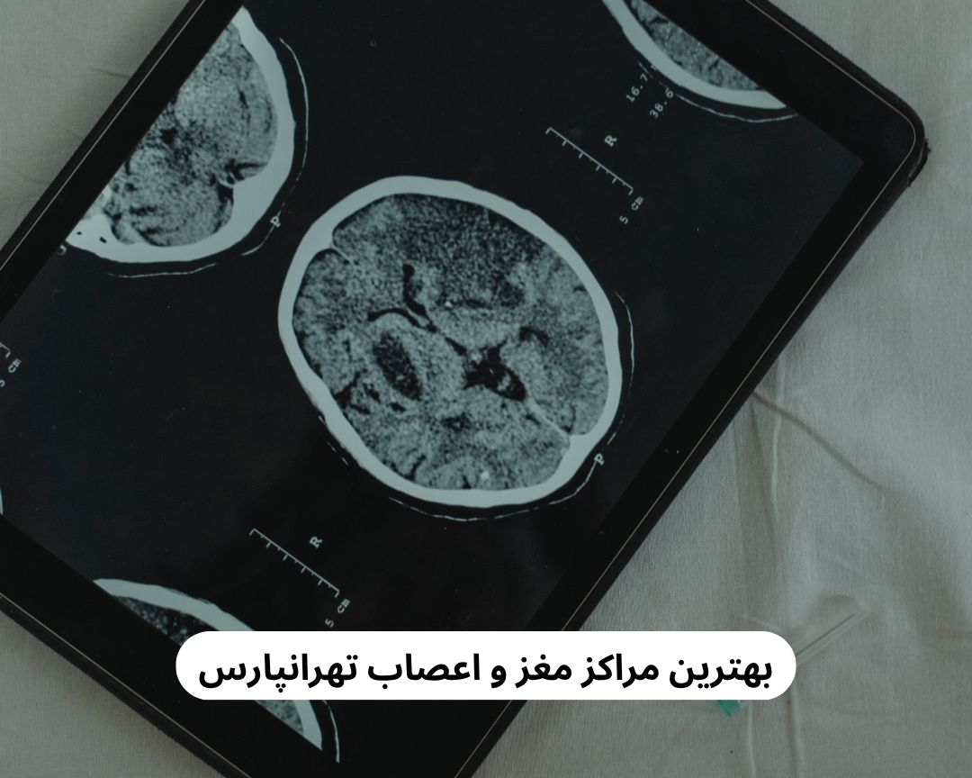 بهترین مراکز مغز و اعصاب تهرانپارس