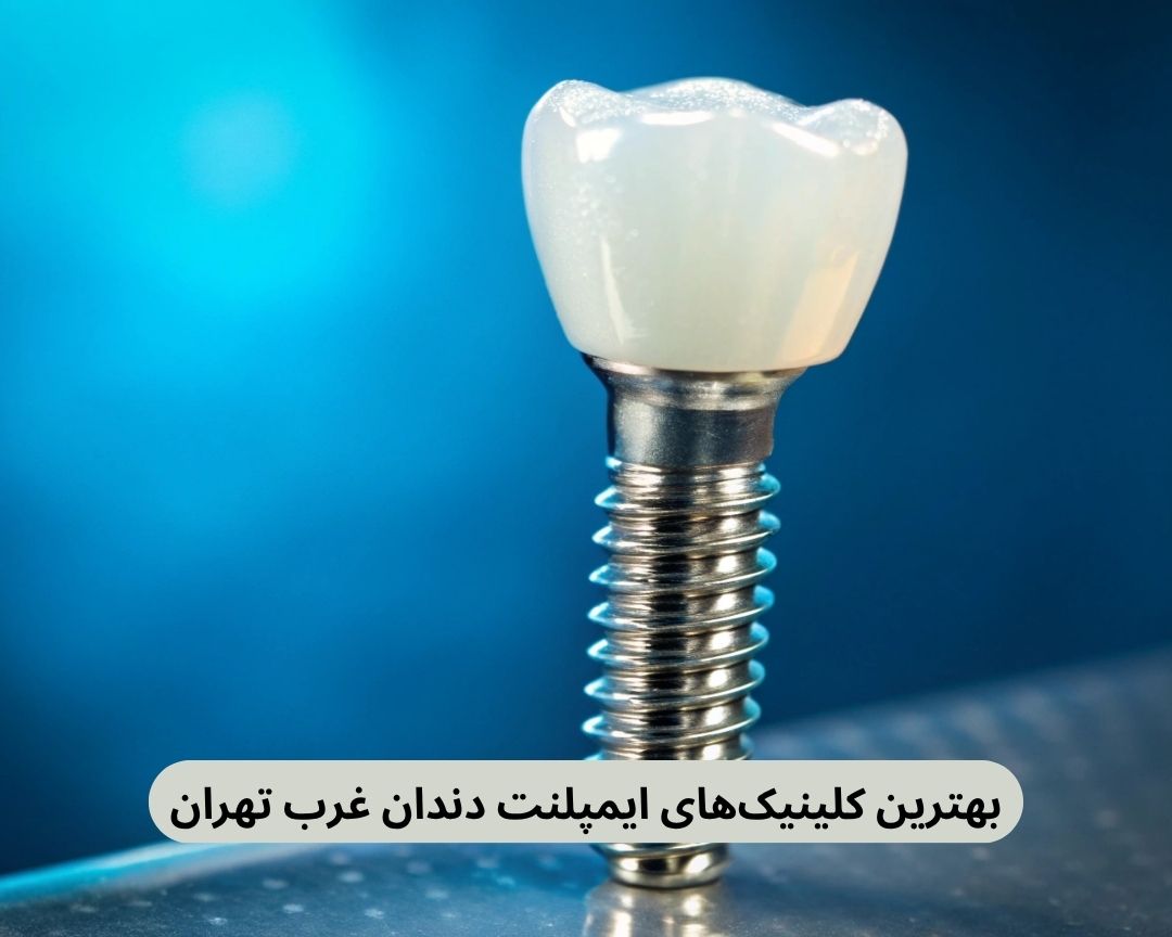بهترین کلینیک های ایمپلنت دندان غرب تهران