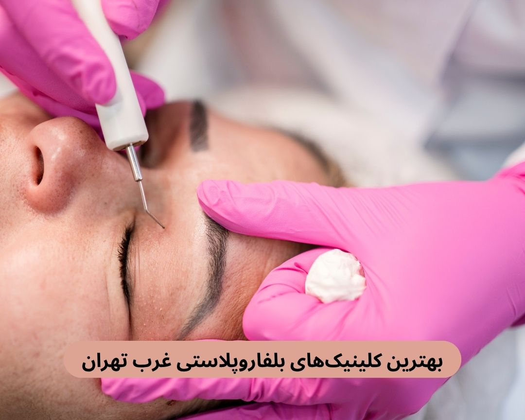 بهترین کلینیک های بلفاروپلاستی غرب تهران