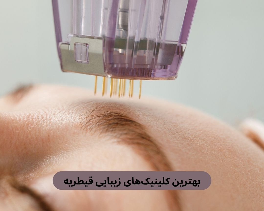 بهترین کلینیک های زیبایی قیطریه