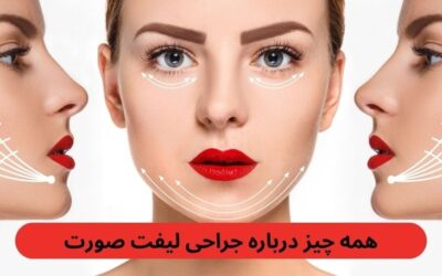 جراحی لیفت صورت: کاربردها، نحوه انجام، آمادگی و مراقبتهای لازم