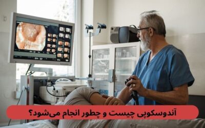 آندوسکوپی چیست و چطور انجام می‌شود؟