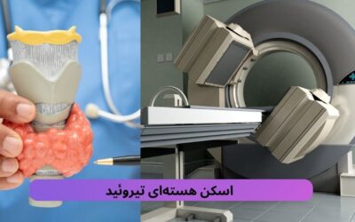 اسکن هسته ای تیروئید چیست؟ نحوه انجام و مراقبت