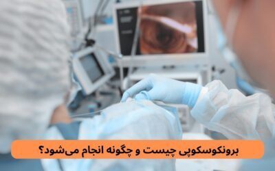 برونکوسکوپی چیست و چگونه انجام می‌شود؟