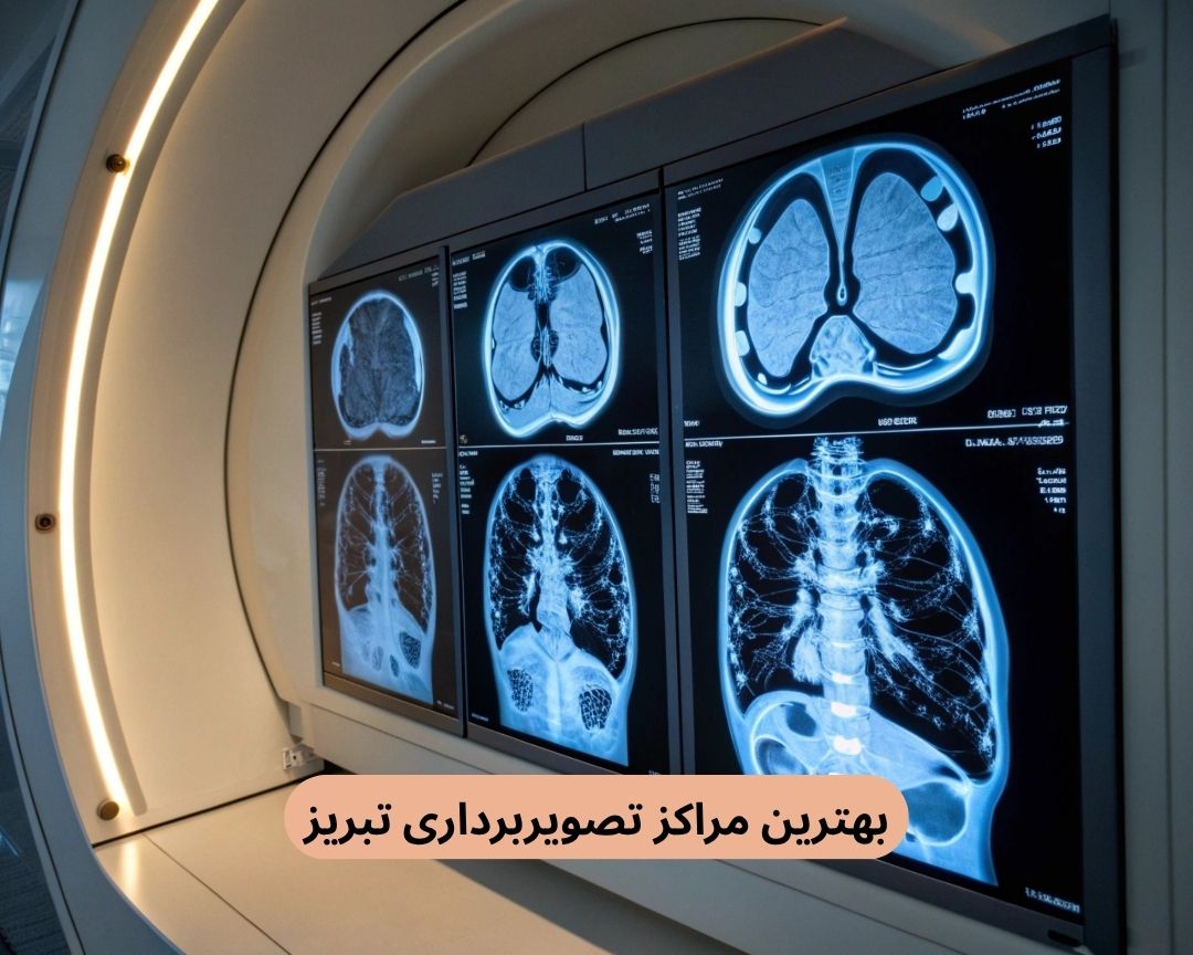 بهترین مراکز تصویربرداری تبریز