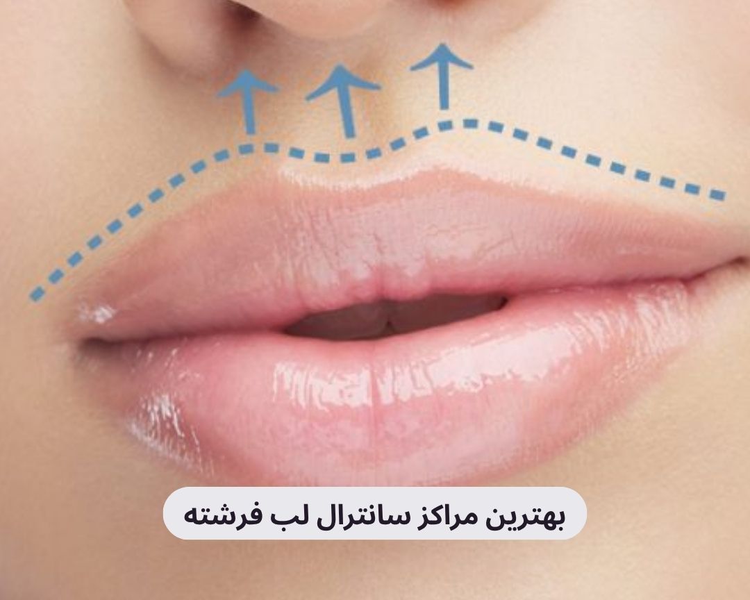 بهترین مراکز سانترال لب فرشته